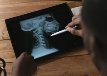 Doctor examining a spinal x-ray on a tablet using a stylus. Modern medical analysis.